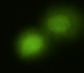 Examples of comet assay results, shown as green blobs dragging tails behind them.